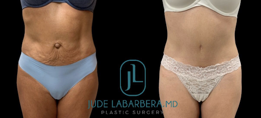 Jude LaBarbera MD Plastic Surgery